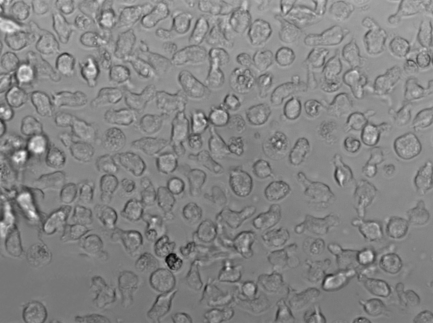 RL Cell|人非霍奇金淋巴瘤细胞,RL Cell