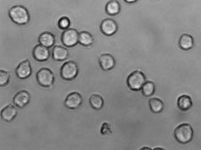 MUTZ-3 Cell|急性非淋巴白血病细胞,MUTZ-3 Cell