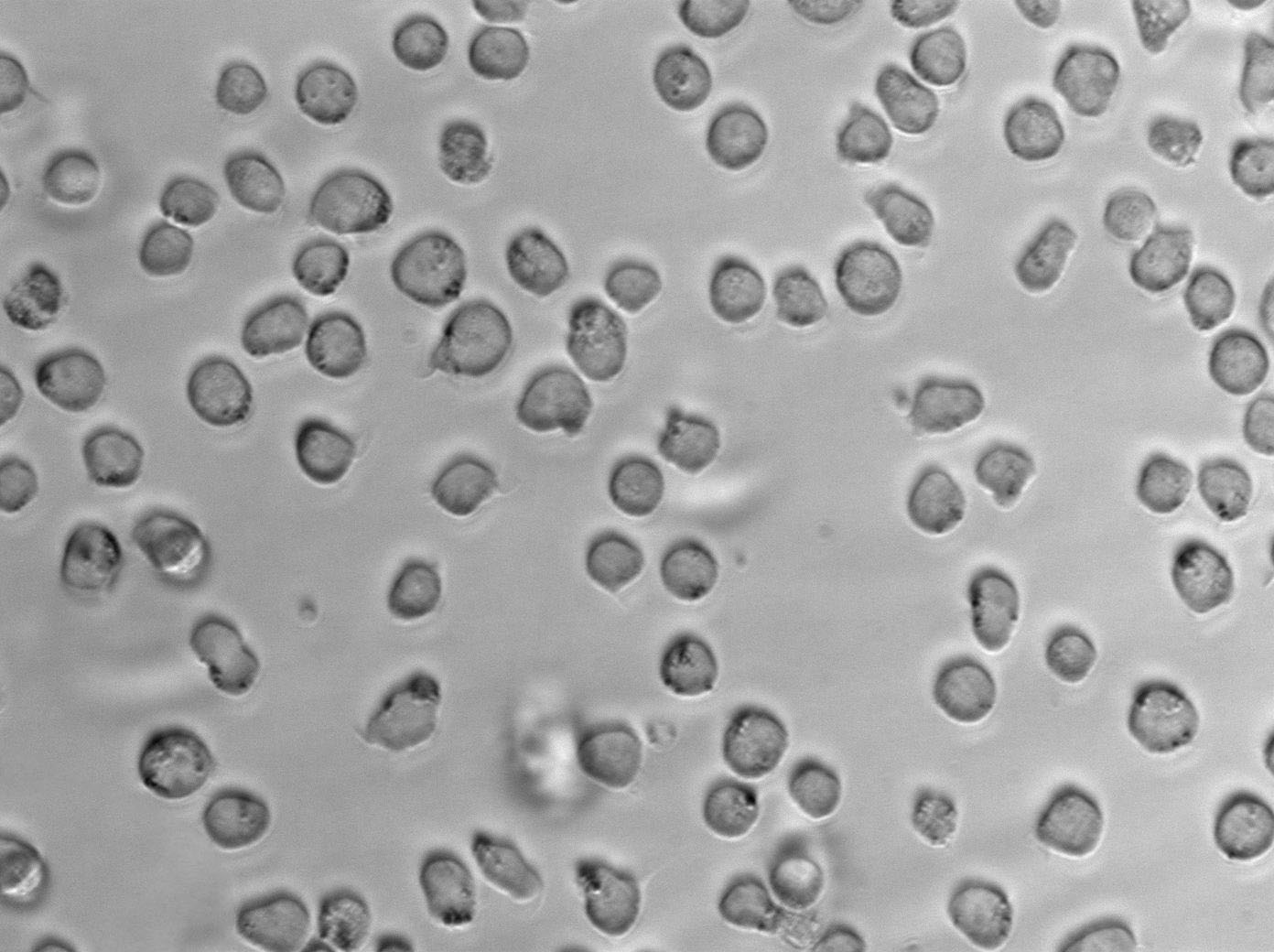 Z-138 Cell|人套细胞淋巴瘤细胞,Z-138 Cell