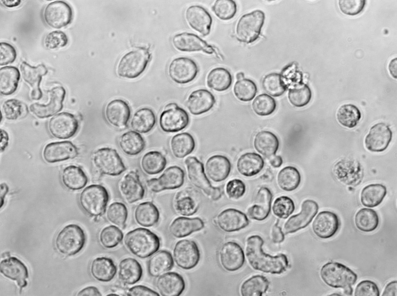 GA-10 Cell|人B淋巴瘤细胞,GA-10 Cell