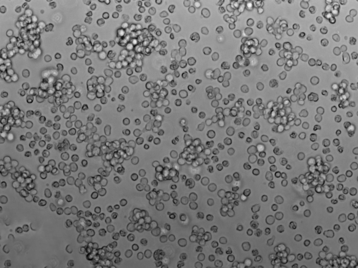 SU-DHL-10 Cell|人B细胞淋巴瘤细胞,SU-DHL-10 Cell