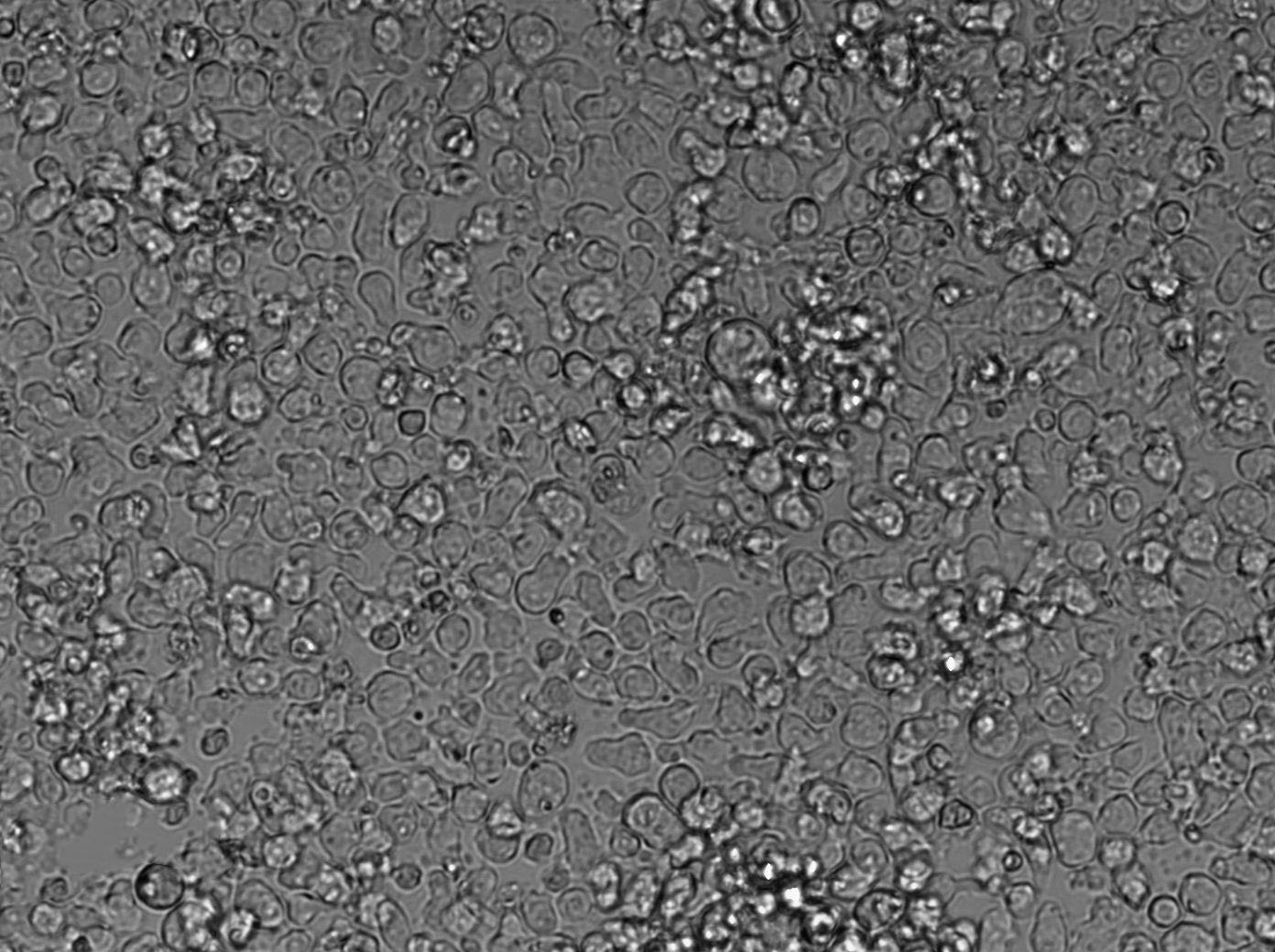 Karpas-299 Cell|人间变性大细胞淋巴瘤细胞,Karpas-299 Cell