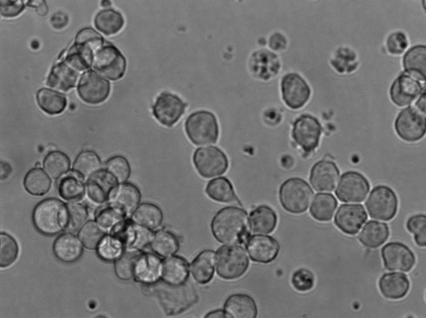 TK-1 Cell|小鼠T淋巴瘤细胞,TK-1 Cell