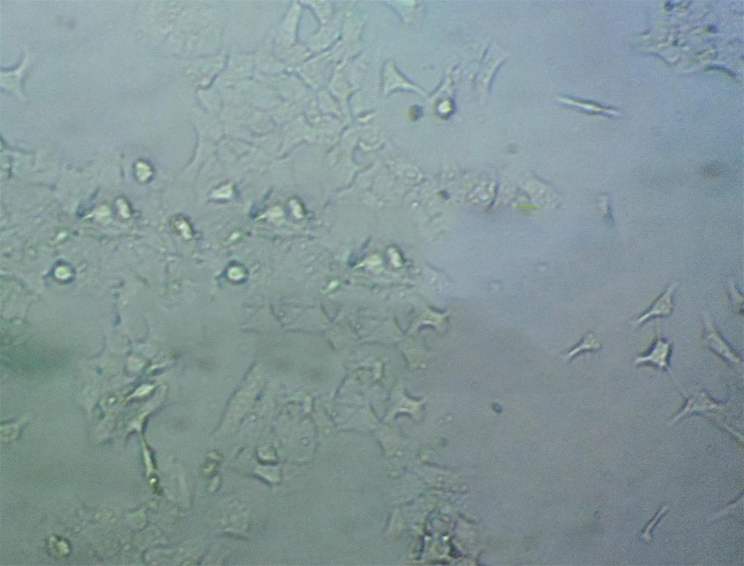 DLD-1 Cell|人结直肠腺癌上皮细胞,DLD-1 Cell