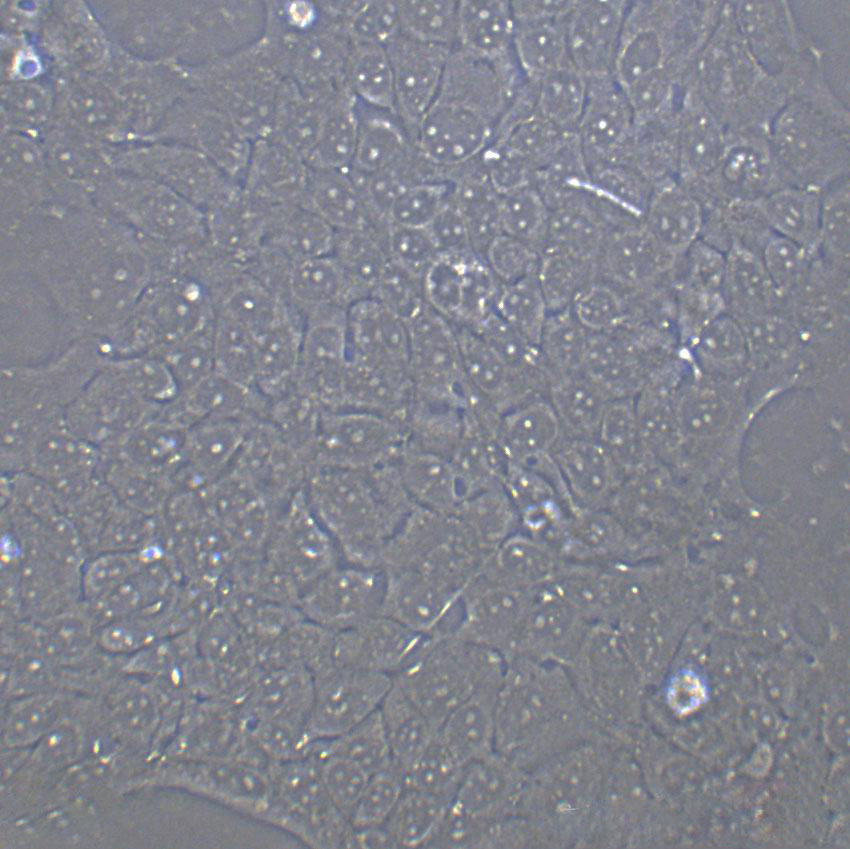 NCI-H358 Cell|人非小細胞肺癌細胞,NCI-H358 Cell