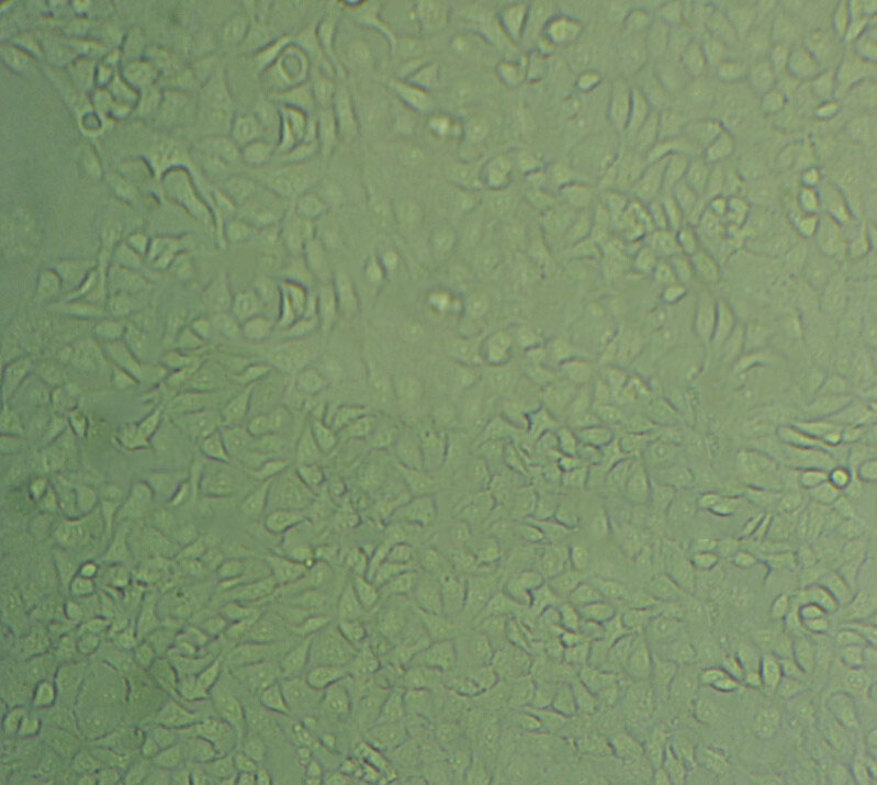 NCI-H661 Cell|人大细胞肺癌细胞,NCI-H661 Cell