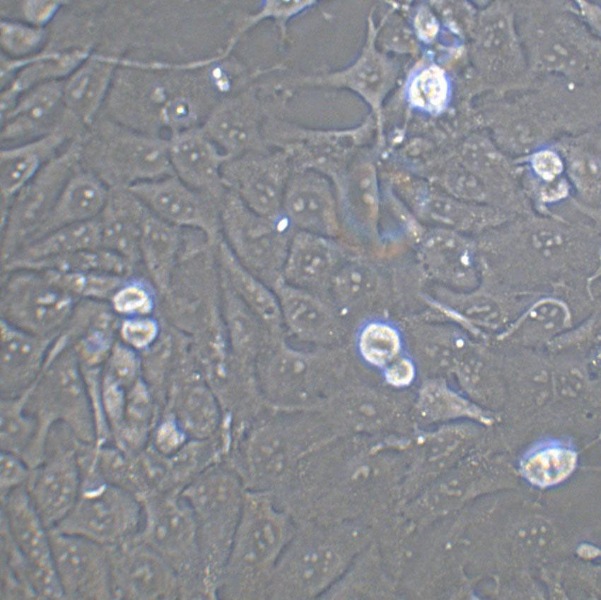 PLC/PRF/5 Cell|人肝癌亚力山大细胞,PLC/PRF/5 Cell