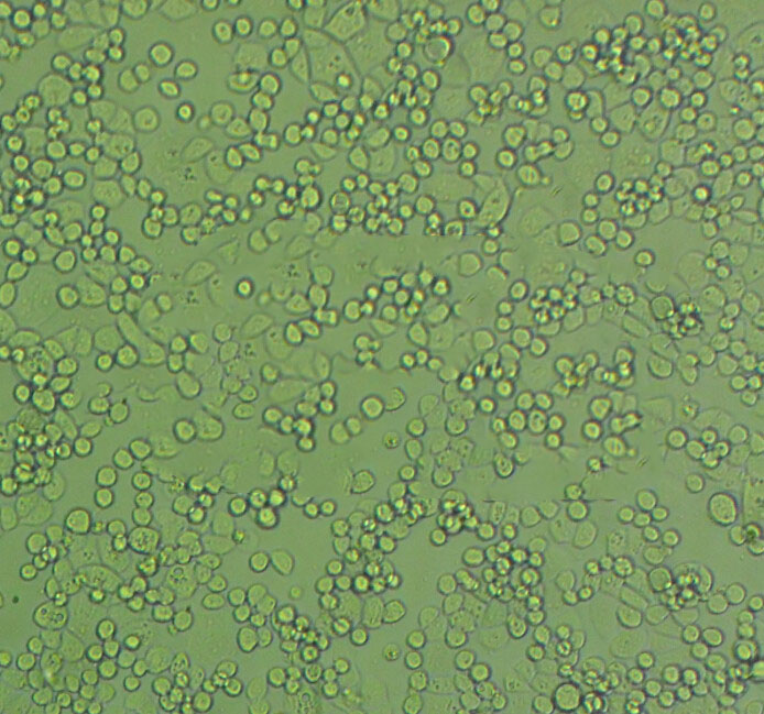 SK-HEP-1 Cell|人肝癌细胞,SK-HEP-1 Cell