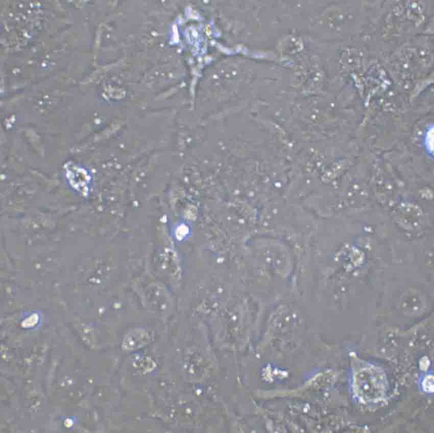 SaOS-2 Cell|人成骨肉瘤细胞,SaOS-2 Cell