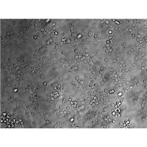 JVM-2 Cell|EB病毒感染的人外周淋巴细胞