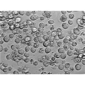 SUP-T1 Cell|人淋巴母细胞淋巴瘤细胞