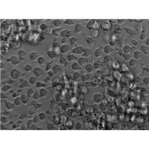 Namalwa Cell|人Burkitt＇s淋巴瘤细胞,Namalwa Cell