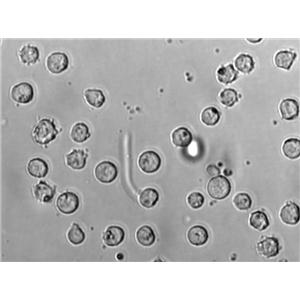 CEM/C1 Cell|人急性淋巴细胞白血病细胞,CEM/C1 Cell