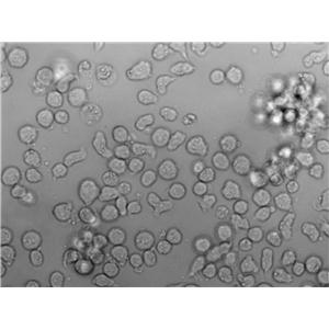 EHEB Cell|人慢性B细胞白血病细胞