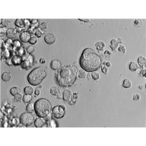 SNK-6 Cell|人NK/T细胞淋巴瘤细胞,SNK-6 Cell