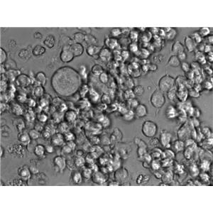 A20 Cell|小鼠B细胞淋巴瘤细胞