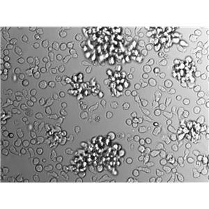 BV-173 Cell|人外周血B细胞白血病细胞