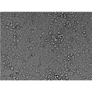 Karpas-299 Cell|人间变性大细胞淋巴瘤细胞