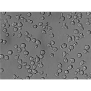 MyLa 2059 Cell|人皮肤T淋巴细胞瘤细胞