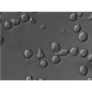 SU-DHL-2 Cell|人弥漫性大细胞淋巴瘤细胞