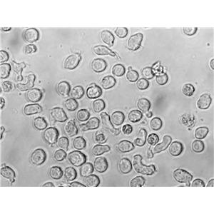 KM932 Cell|人B淋巴细胞