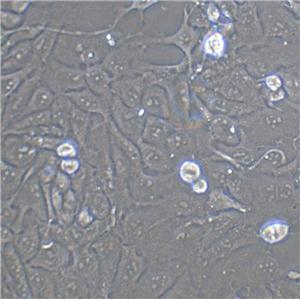 PLC/PRF/5 Cell|人肝癌亚力山大细胞