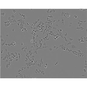 SMMC-7721 Cell|人肝癌细胞