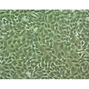 MHCC97-H Cell|高转移人肝癌细胞