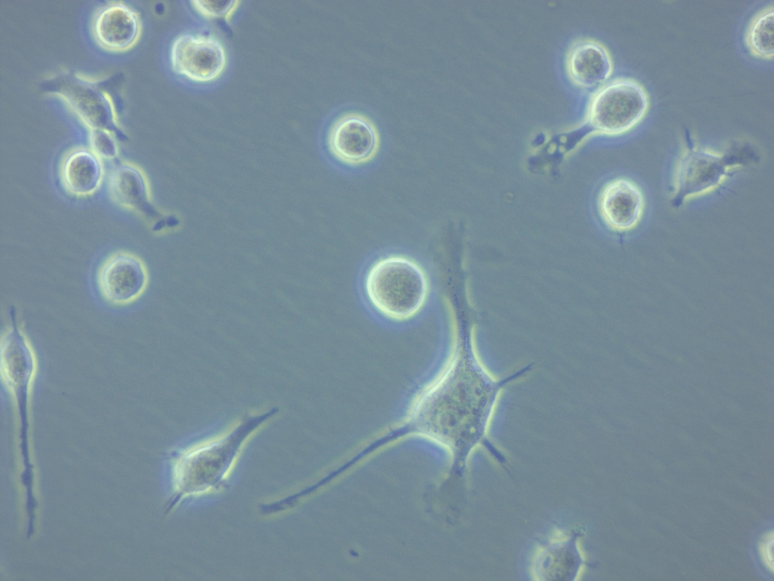 GDM-1人白血病复苏细胞(附STR鉴定报告),GDM-1