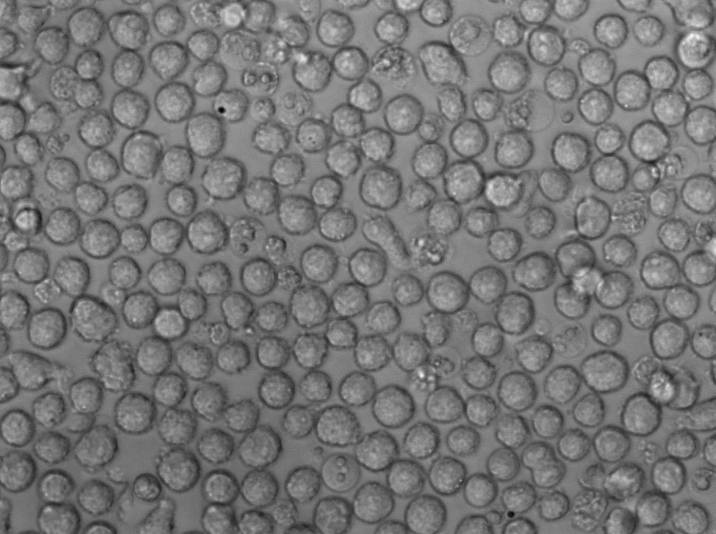 NCI-H929人浆细胞白血病复苏细胞(附STR鉴定报告),NCI-H929