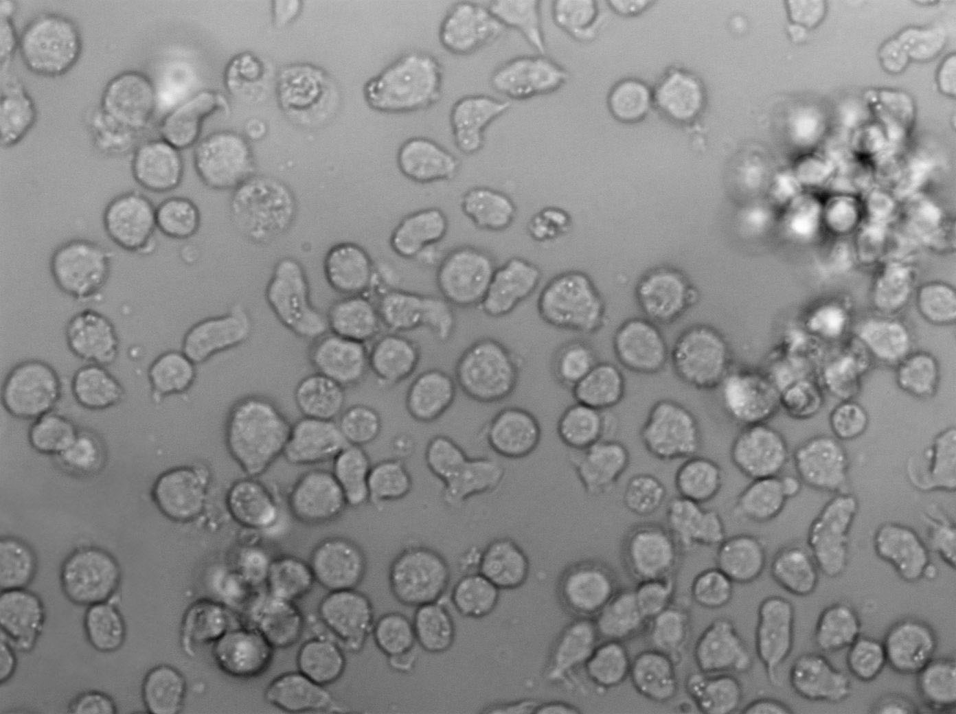 SU-DHL-10人B细胞淋巴瘤复苏细胞(附STR鉴定报告),SU-DHL-10