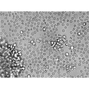 HEL人红白细胞白血病复苏细胞(附STR鉴定报告),HEL