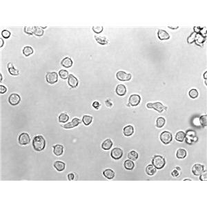 U-937人组织细胞淋巴瘤复苏细胞(附STR鉴定报告)