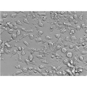 Reh人急性非B非T淋巴细胞性白血病复苏细胞(附STR鉴定报告)