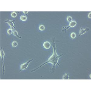 GDM-1人白血病复苏细胞(附STR鉴定报告)