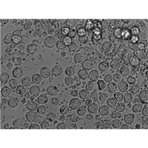 GA-10 clone 4人B淋巴细胞瘤复苏细胞(附STR鉴定报告)