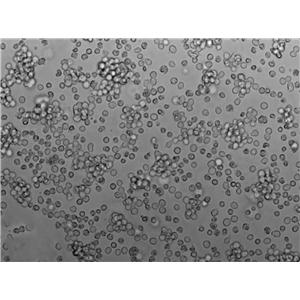 OCI-AML-3人急性髓细胞性白血病复苏细胞(附STR鉴定报告),OCI-AML-3