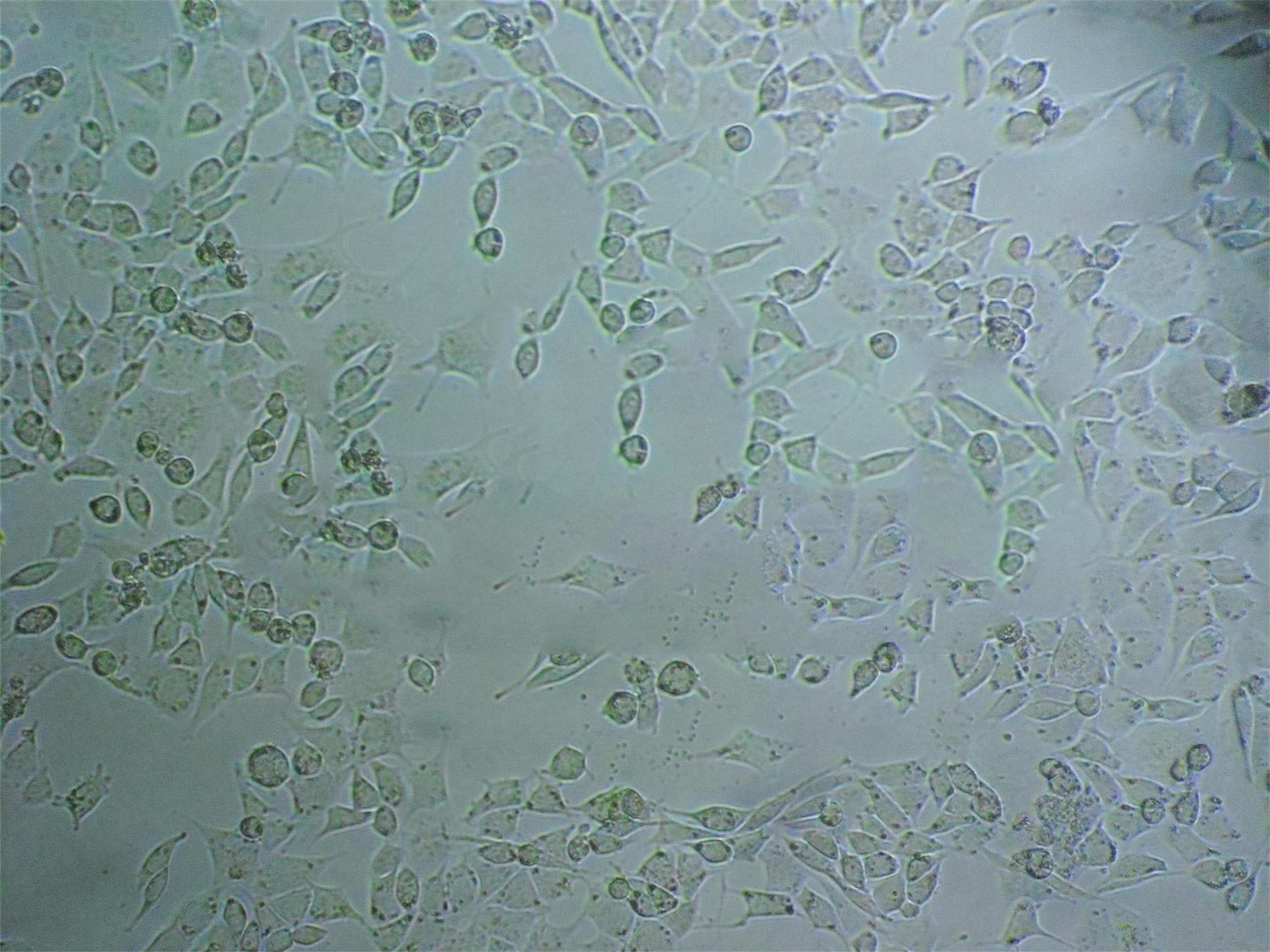 BEL-7404 Cells(赠送Str鉴定报告)|人肝癌细胞,BEL-7404 Cells