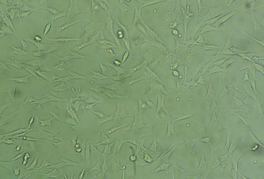 ACC-3 Cells(赠送Str鉴定报告)|人涎腺腺样囊性癌细胞,ACC-3 Cells