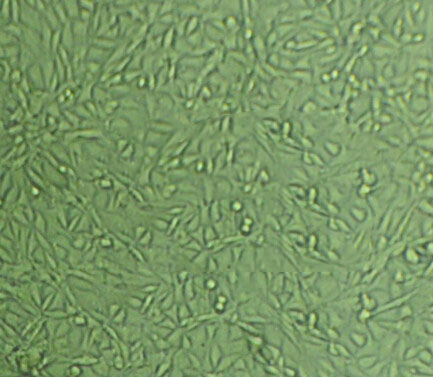 HO-8910 Cells(赠送Str鉴定报告)|人卵巢癌细胞,HO-8910 Cells