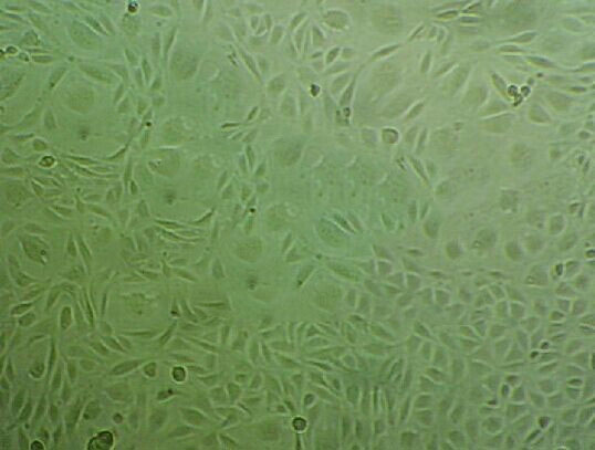 CAL-27 Cells(赠送Str鉴定报告)|人舌鳞状上皮细胞癌细胞,CAL-27 Cells