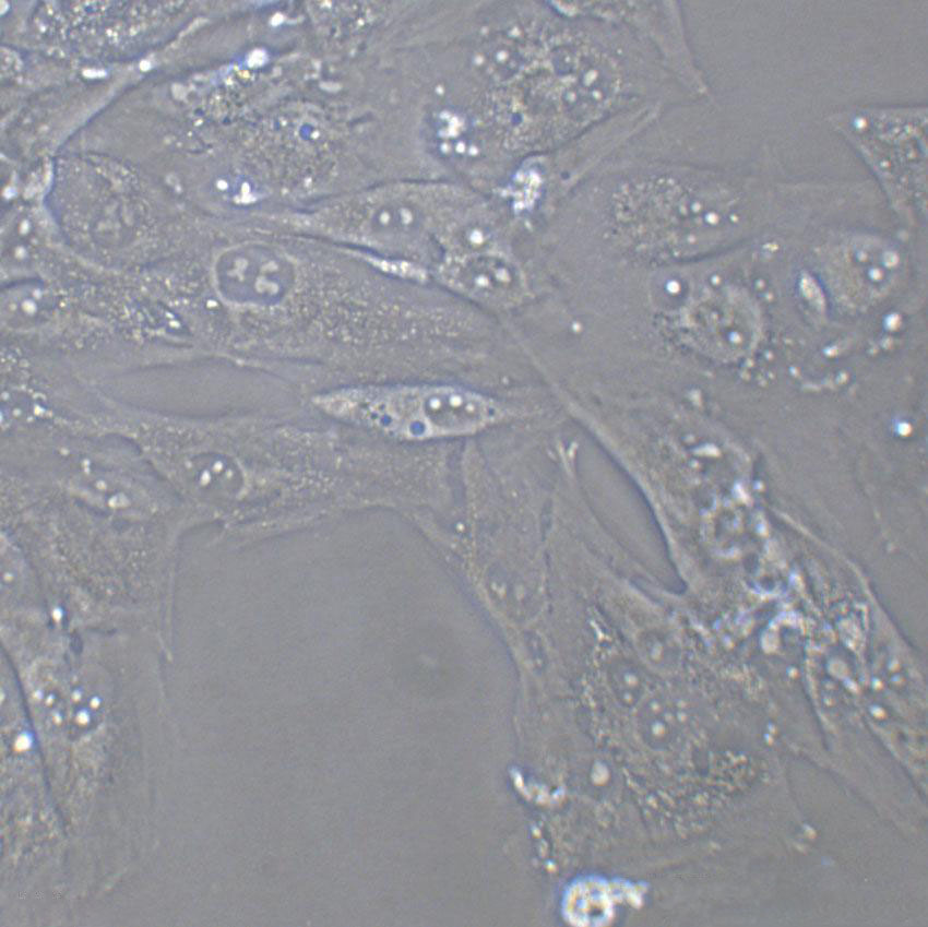 SCC-9 Cells(赠送Str鉴定报告)|人类鳞状上皮舌癌细胞,SCC-9 Cells