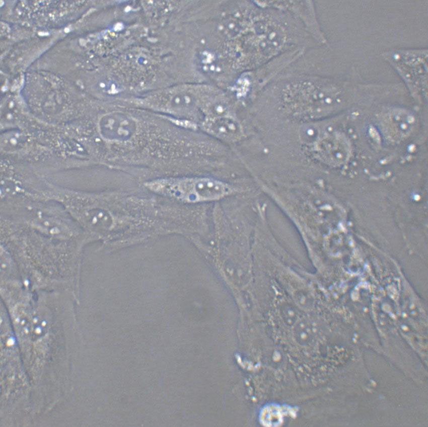 SCC-9 Cells(贈(zèng)送Str鑒定報(bào)告)|人類鱗狀上皮舌癌細(xì)胞,SCC-9 Cells