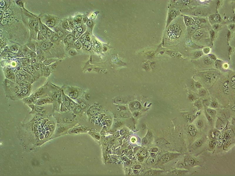 SCC-4 Cells(贈送Str鑒定報(bào)告)|人類鱗狀上皮舌癌細(xì)胞,SCC-4 Cells