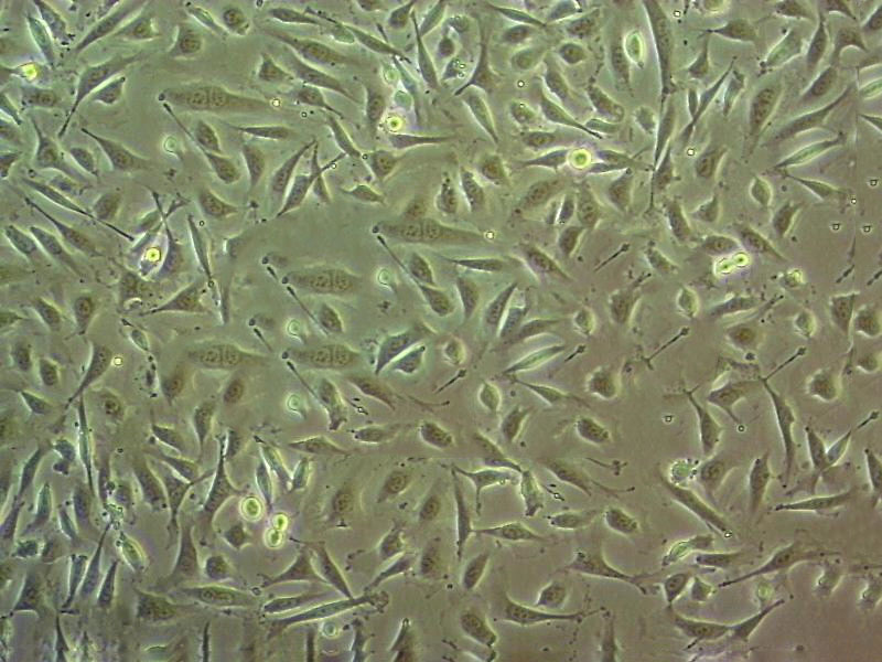 PANC-1 Cells(赠送Str鉴定报告)|人胰腺癌细胞,PANC-1 Cells