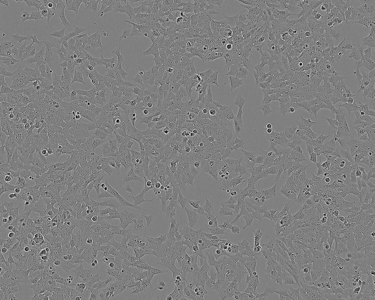 Ishikawa Cells(赠送Str鉴定报告)|人子宫内膜癌细胞,Ishikawa Cells
