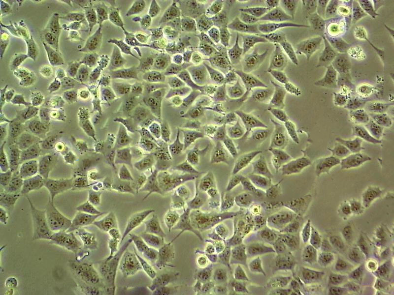 ME-180 Cells(赠送Str鉴定报告)|人子宫颈表皮癌细胞,ME-180 Cells