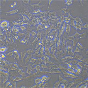 KB Cells(赠送Str鉴定报告)|口腔表皮样癌细胞