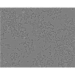 HBL-100 Cells(赠送Str鉴定报告)|人整合SV40基因的乳腺上皮细胞