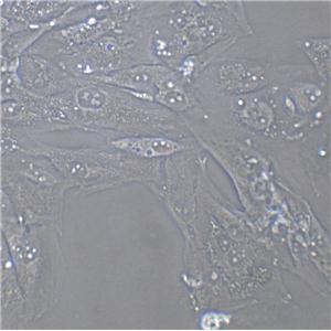 SCC-9 Cells(赠送Str鉴定报告)|人类鳞状上皮舌癌细胞,SCC-9 Cells